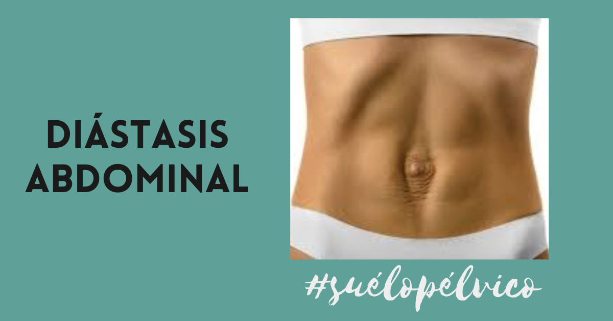 diástasis abdominal