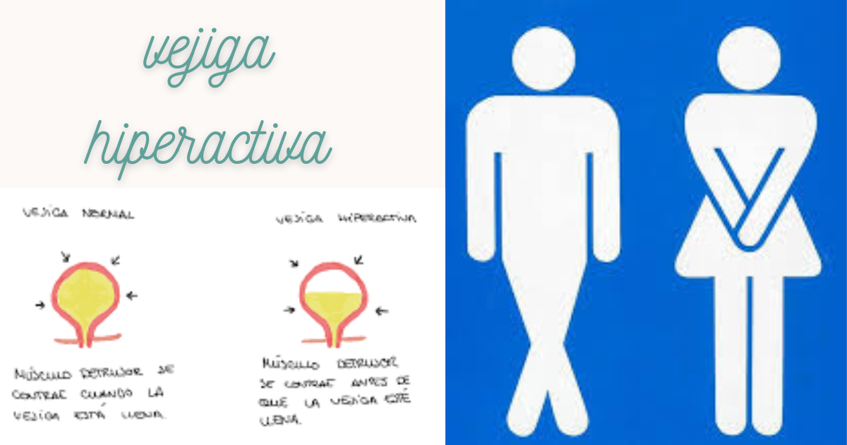 vejiga hiperactiva